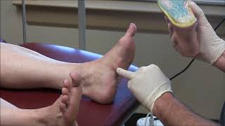 Plantar Fasciitis Causes Symptoms amp Treatment [upl. by Steddman]