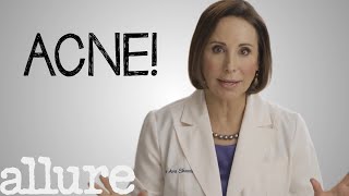 What is Acne and How Do I Get Rid of it Forever  Allure [upl. by Ahtenak444]