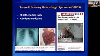 Leptospirosis Clinical Disease and Diagnosis in Humans [upl. by Noiraa]