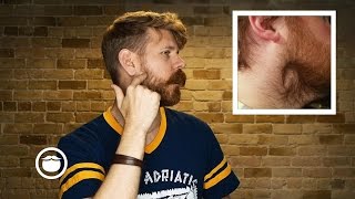 How To Deal With Beard Cowlicks [upl. by Haramat980]