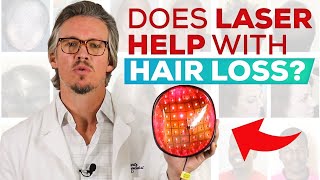 Laser Treatment For Hair Loss And Hair Regrowth Does It Work QampA [upl. by Nilhsa822]