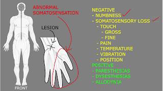 Somatosensory symptoms and signs [upl. by Ab]