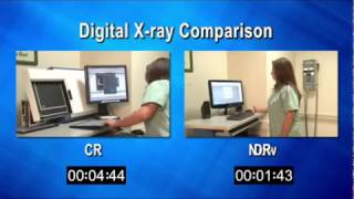 CR amp DR Comparison [upl. by Edyth242]