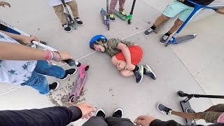 KID BROKE HIS LEG so sad  Wezmas World Ep 3 [upl. by Frager]